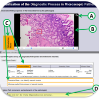 Towards a Deeper Understanding of How a Pathologist Makes a Diagnosis 